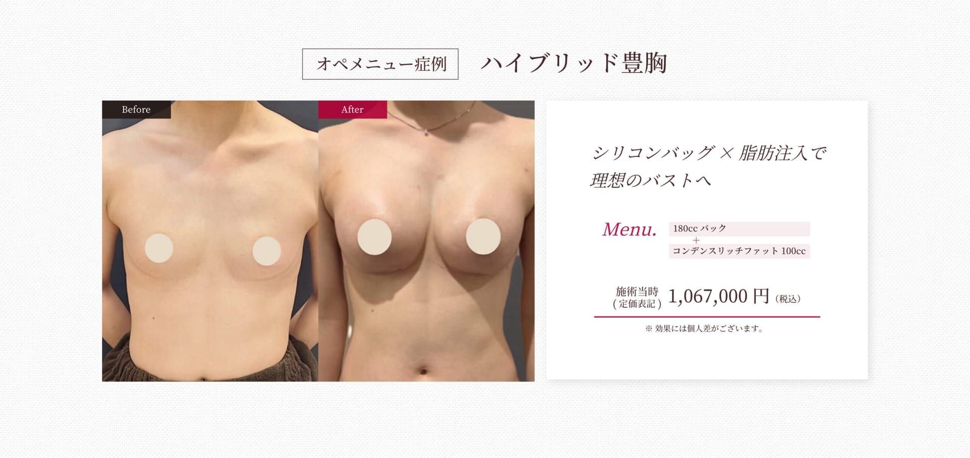 施工イメージ 4
