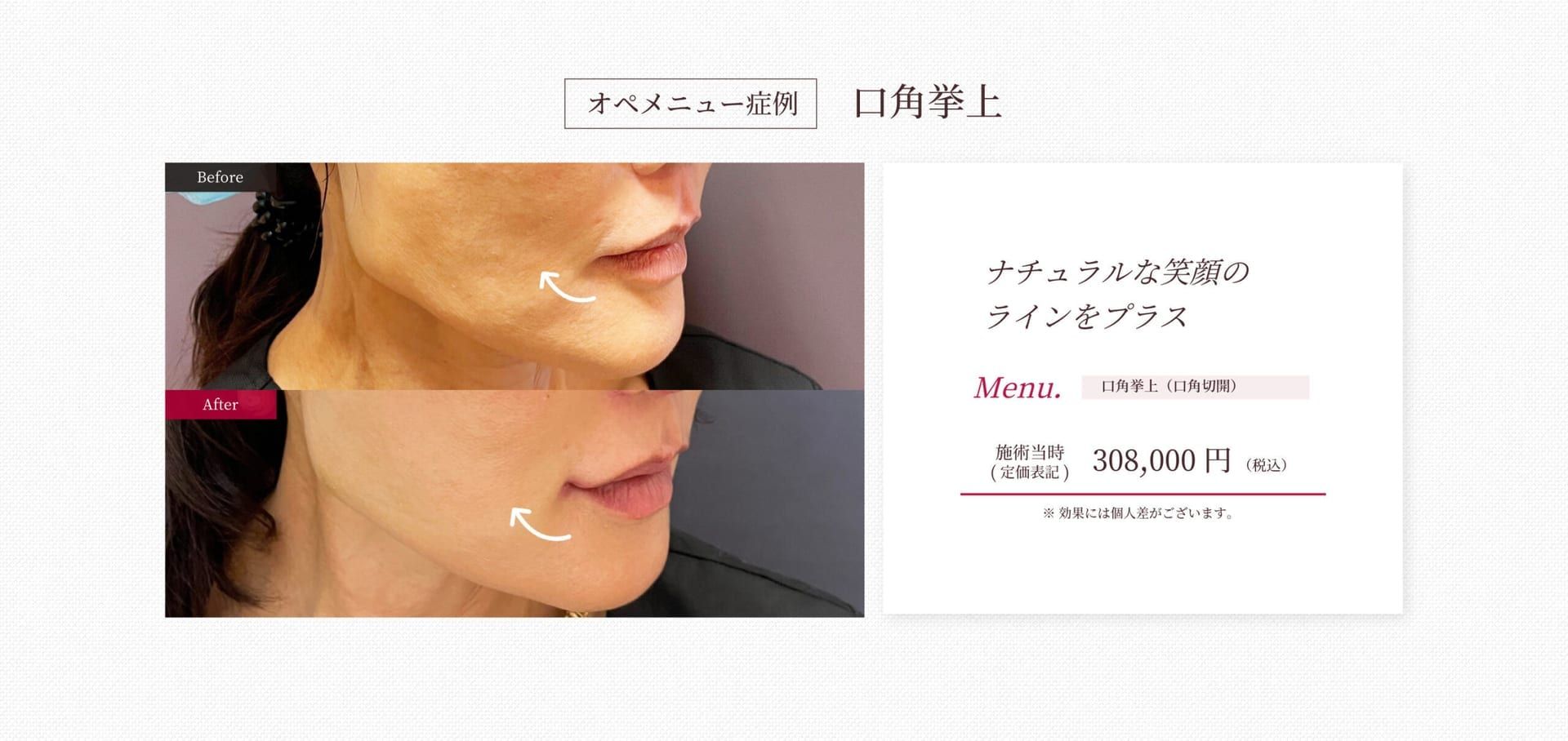 施工イメージ 6