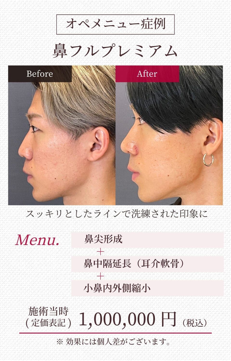 施工イメージ 8