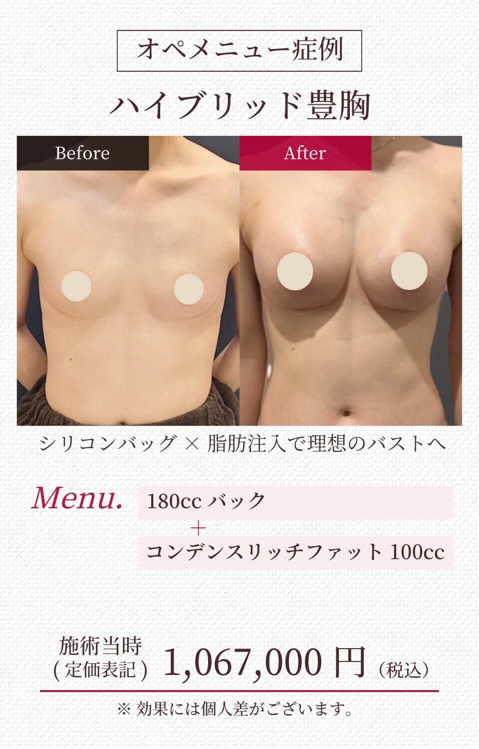 施工イメージ 9
