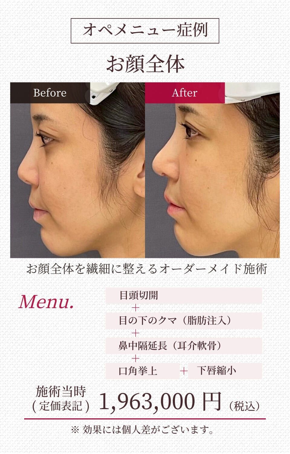 施工イメージ 10